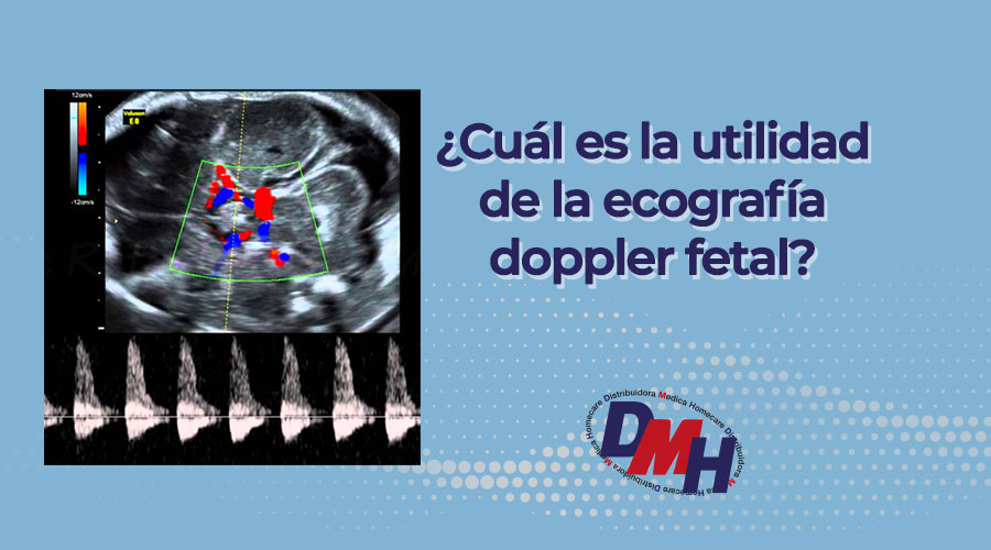 ¿Cuál es la utilidad de la ecografía doppler fetal?